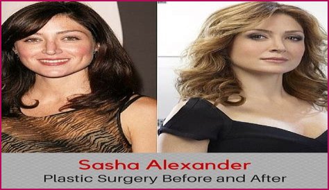 Sasha Alexander Plastic Surgery Before and After
