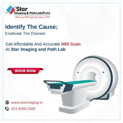 Get Your MRI Scan Done At Best Price In Star Imaging And Path Lab