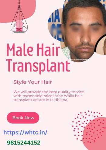 Hair transplant in Ludhiana -walia hair transplant