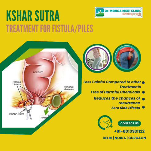 Kshar sutra therapy for piles | Dr Jyoti Aroa – 8010931122